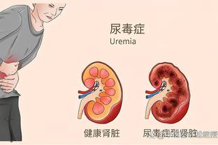 基德：普罗斯珀下赛季可能会进入轮换 他要为上场时间而奋斗